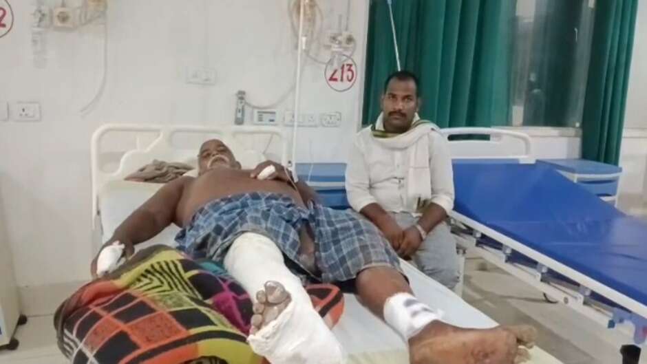 जंगल में पशुपालक पर कुल्हाड़ी से जानलेवा हमला, पैर की हड्डियां टूटीं